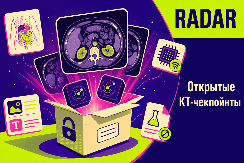Alibaba DAMO Academy открыла модель RADAR для анализа КТ